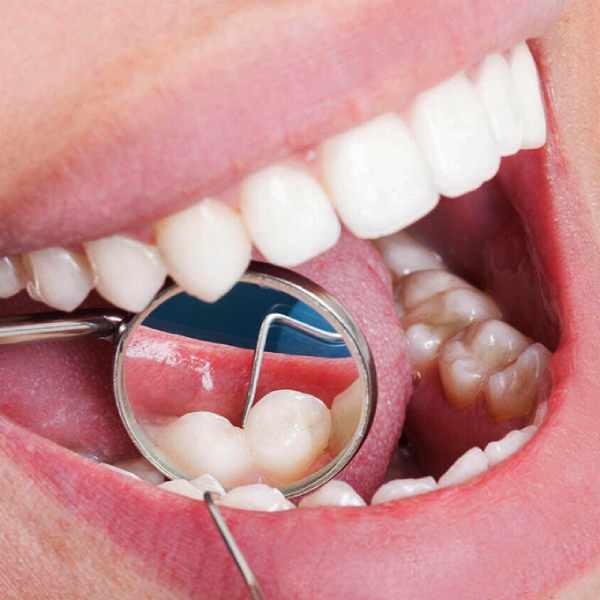 gum-cancer-symptoms-and-treatment-methods