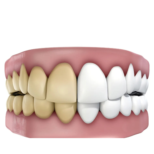 what-is-the-color-of-healthy-and-unhealthy-gums